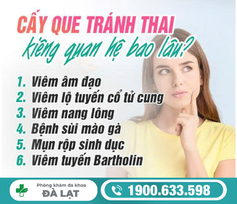 Hình ảnh minh họa